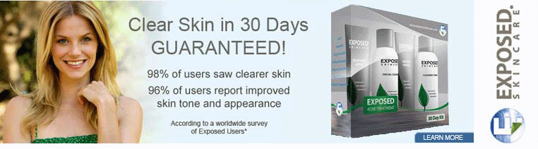 Exposed Skin Care UK